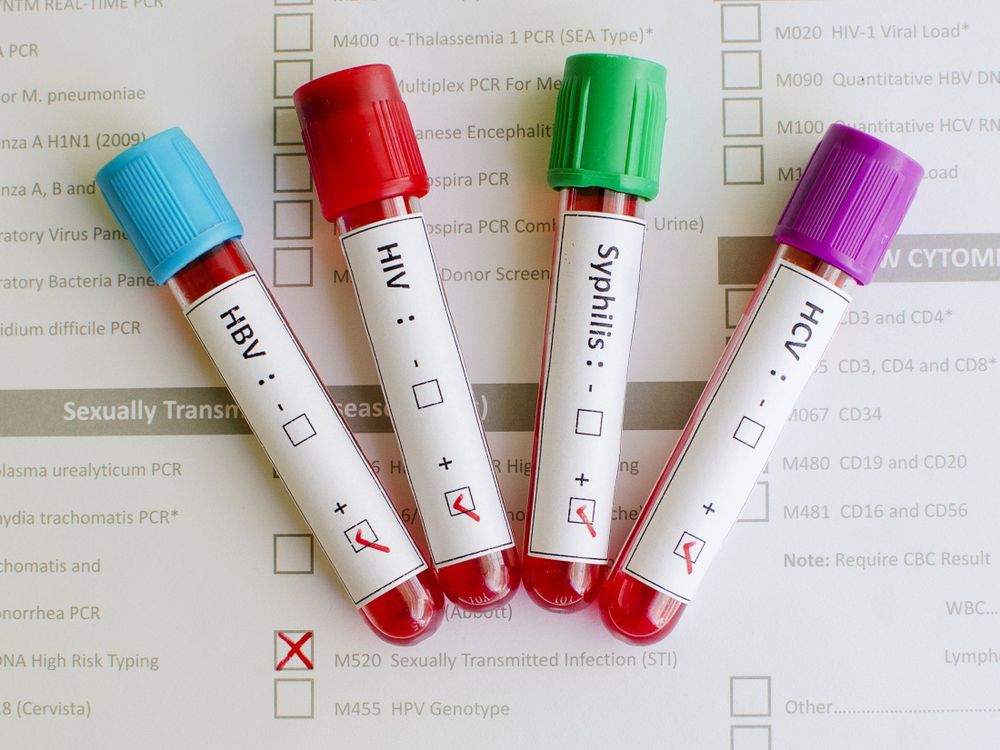 How Much Does STD Treatment Cost Without Insurance In 2024 Mira Health