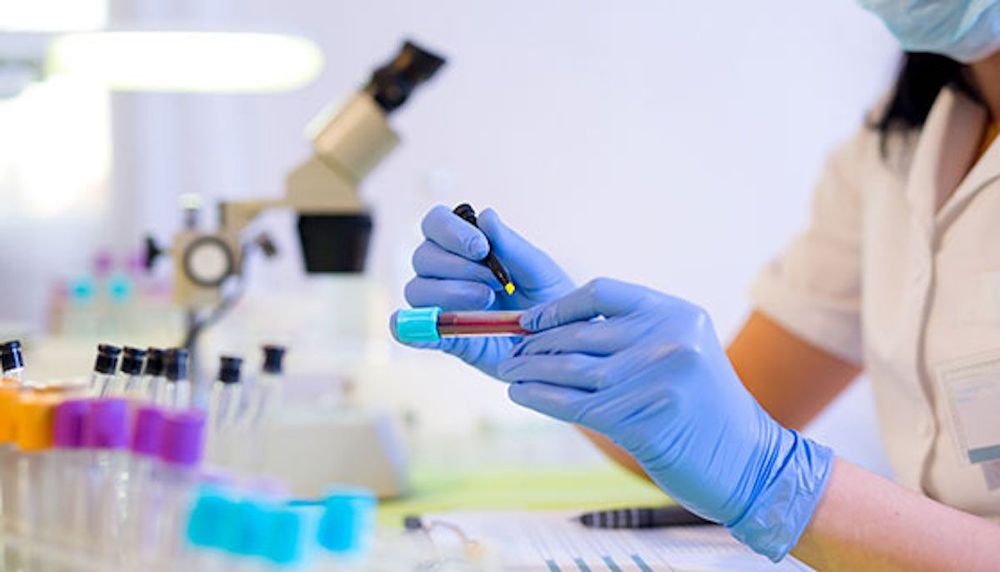 Free Antibody Testing Locations in NYC Mira Health