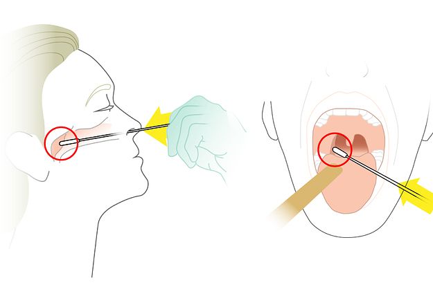 Where To Get Tested For Coronavirus Covid 19 In San Francisco Mira
